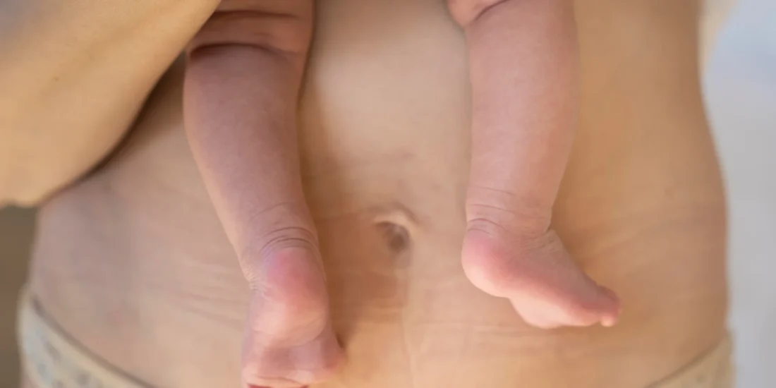 Stopy noworodka oparte o brzuch kobiety po ciąży, widoczne zmiany poporodowe ciała, regeneracja po porodzie, trening mięśni kegla i przygotowanie do porodu.